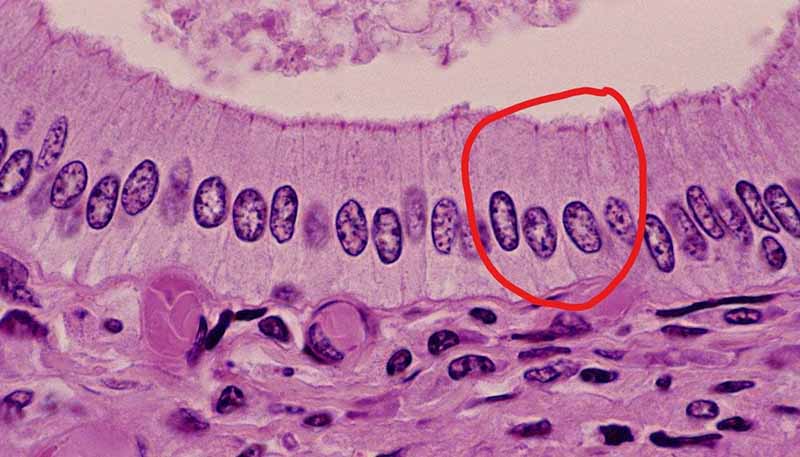 柱狀上皮細(xì)胞圖
