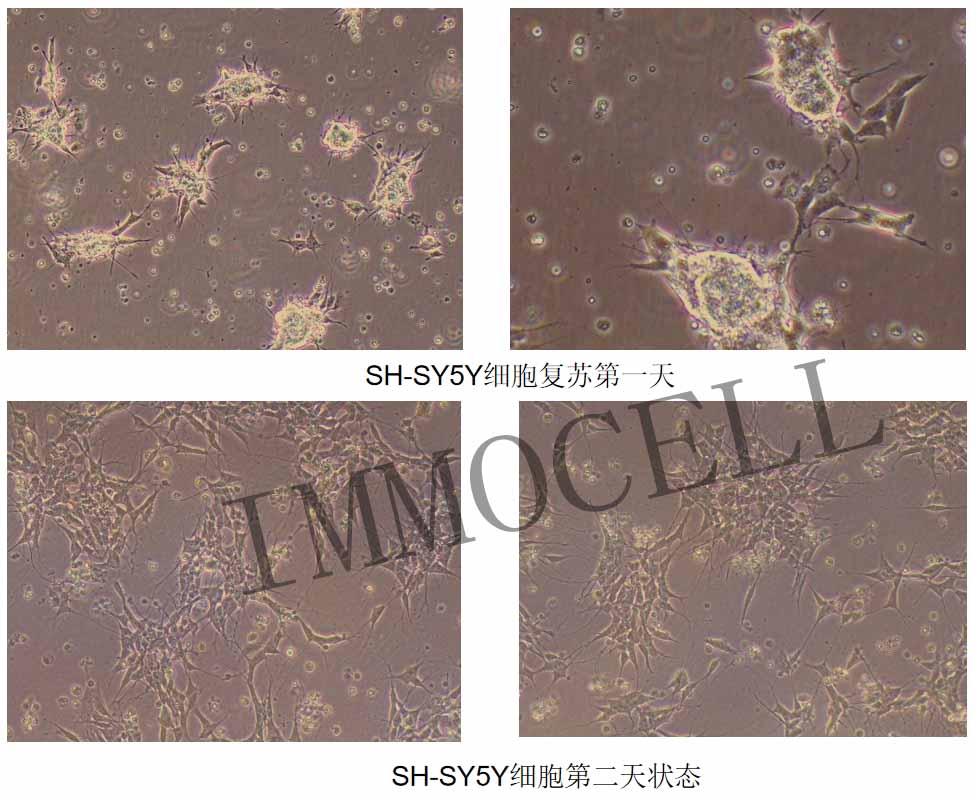 SH-SY5Y細(xì)胞復(fù)蘇狀態(tài)圖