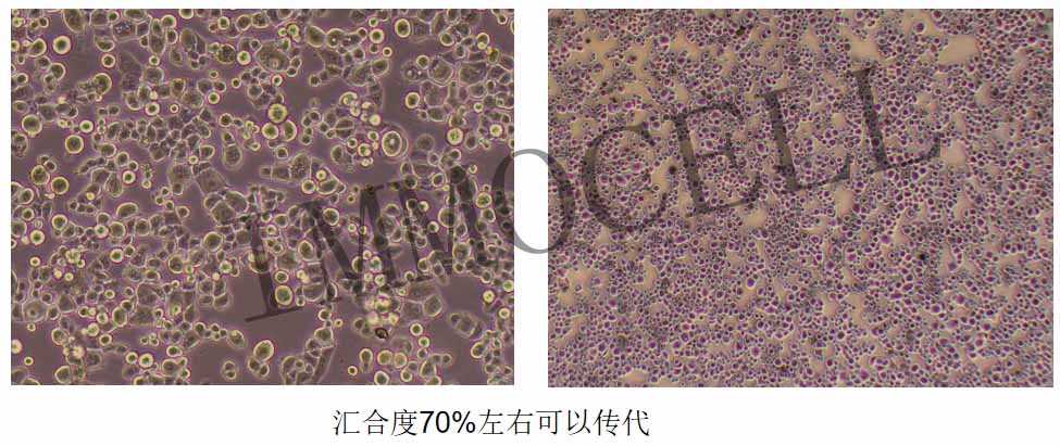 ZR-75-30人乳腺癌細(xì)胞傳代密度圖