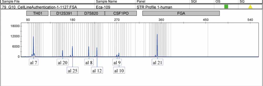 Eca-109人食管癌細(xì)胞.jpg