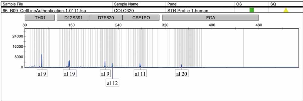 COLO320人結(jié)直腸腺癌細胞.jpg