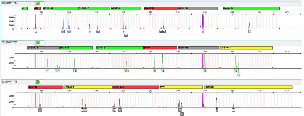 NCI-H716人結(jié)直腸腺癌細(xì)胞.jpg