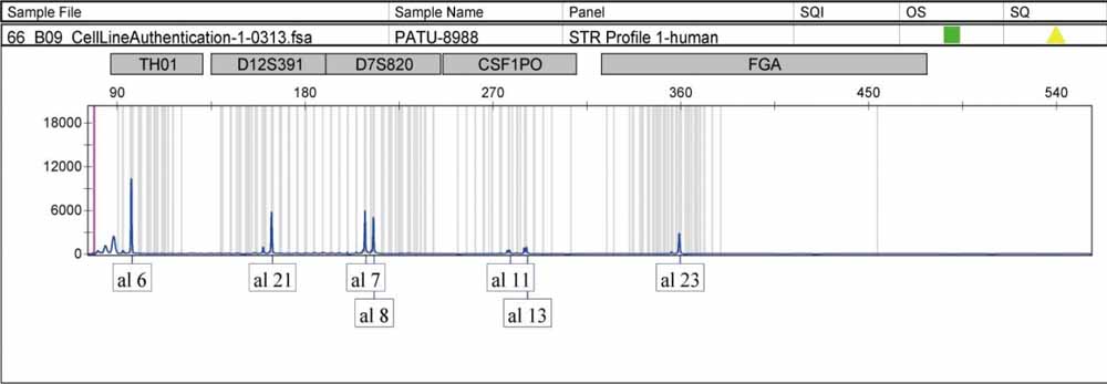 PATU 8988t人胰腺癌細胞.jpg