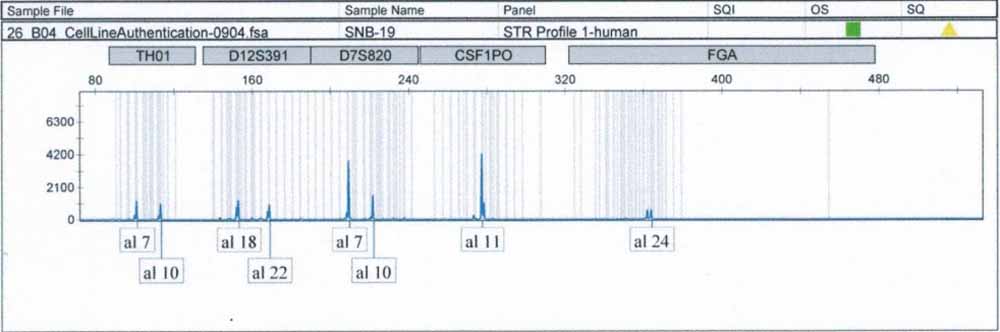 SNB-19人膠質(zhì)瘤細胞.jpg