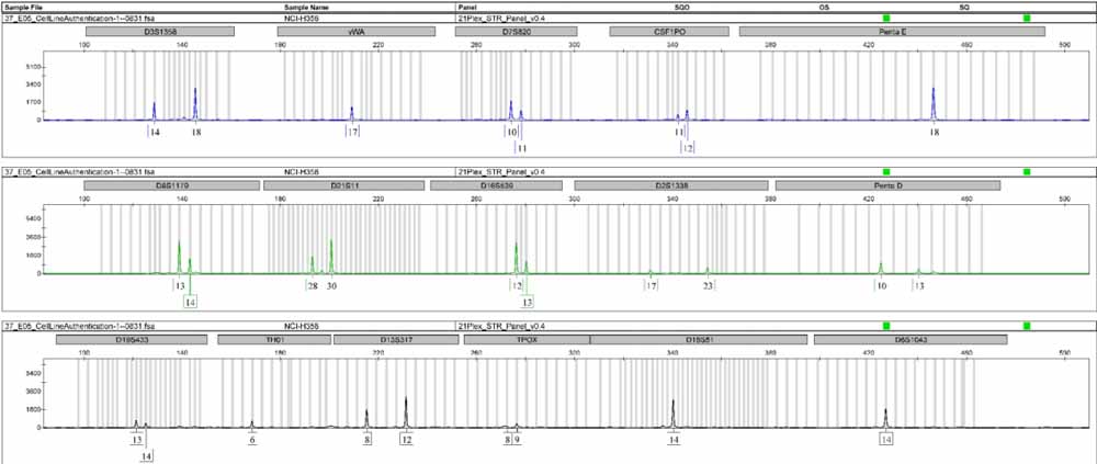 NCI-H358人非小細(xì)胞肺癌細(xì)胞.jpg