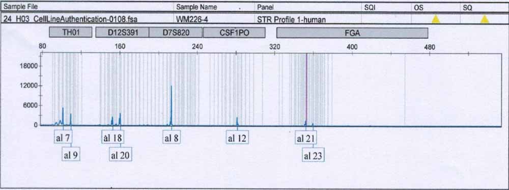 WM-115人惡性黑色素瘤細胞.jpg