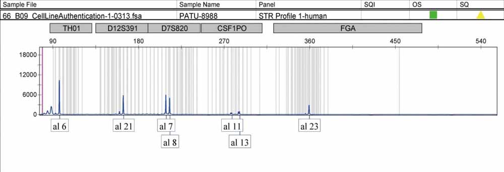 PATU 8988S人胰腺癌細(xì)胞.jpg