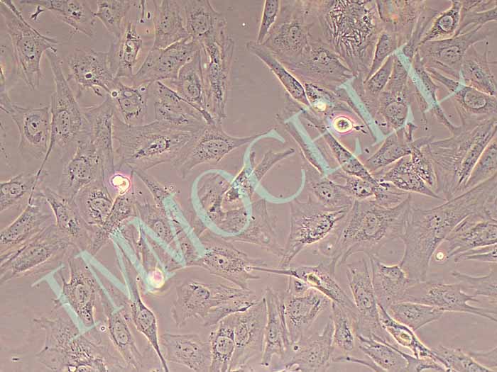人瘢痕疙瘩成纖維細胞永生化（免疫熒光鑒定報告）圖片