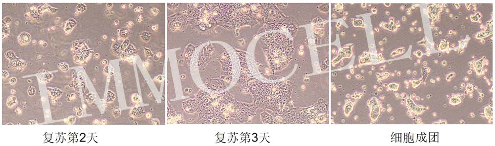 RL95-2人子宮內膜癌細胞復蘇圖片