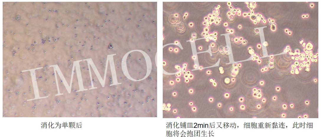 PANC-1人胰腺癌細(xì)胞消化后抱團(tuán)圖片