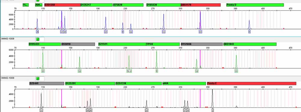 NCI-H295R人腎上腺皮質(zhì)腺癌細(xì)胞 .jpg