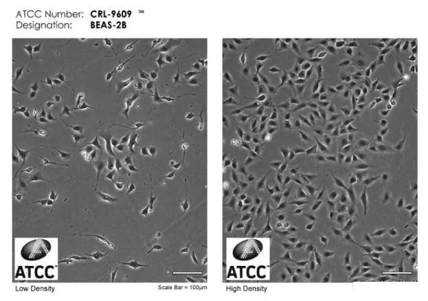 BEAS-2B人支氣管上皮樣細(xì)胞atcc形態(tài)