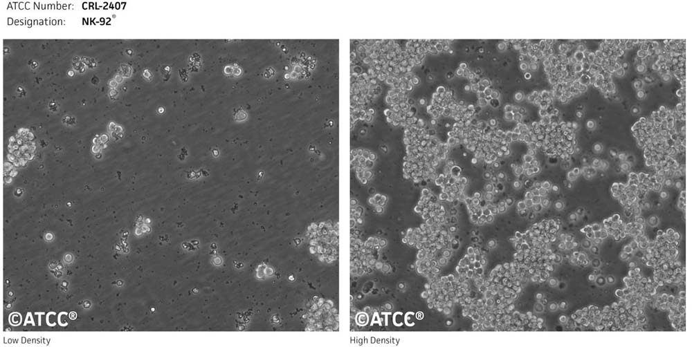NK-92細胞atcc形態(tài)