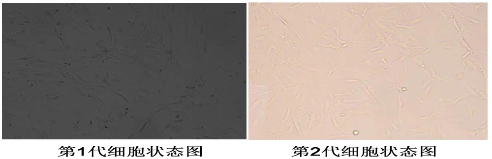 人軟骨細(xì)胞傳代后變形圖片