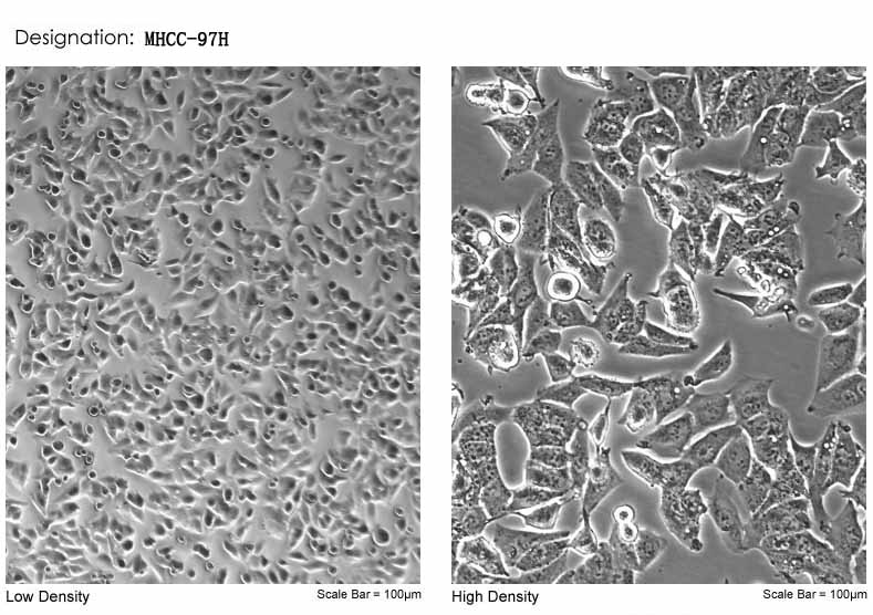 MHCC-97H人高轉移性肝癌細胞形態(tài)特征圖片
