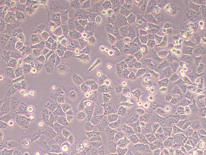 MCF-7/TAM人乳腺癌他莫昔芬耐藥細胞株圖片