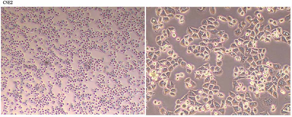 CNE2人鼻咽癌細(xì)胞形態(tài)圖片